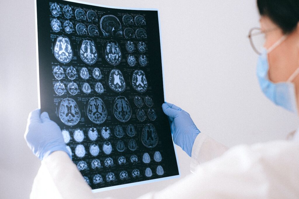 neurologist
