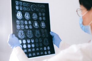Read more about the article Looking for Neurologists? Here are 7 tips to help you