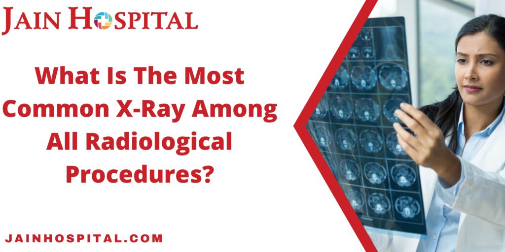 What Is The Most Common X-Ray Among All Radiological Procedures?