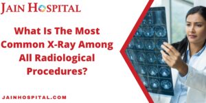 Read more about the article What Is The Most Common X-Ray Among All Radiological Procedures?