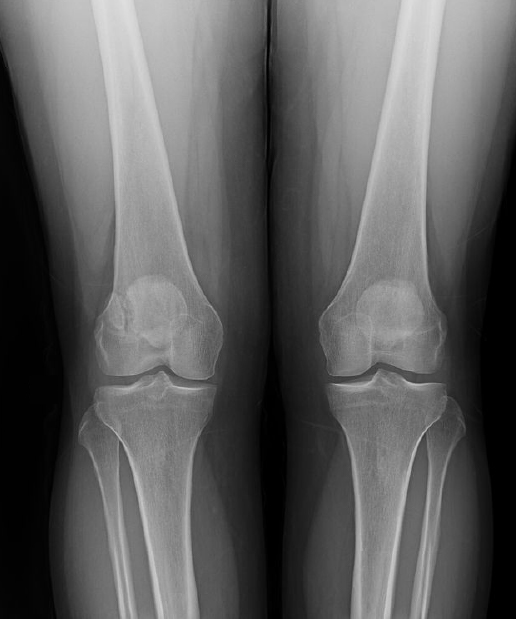 Bone & Joint X-Ray.