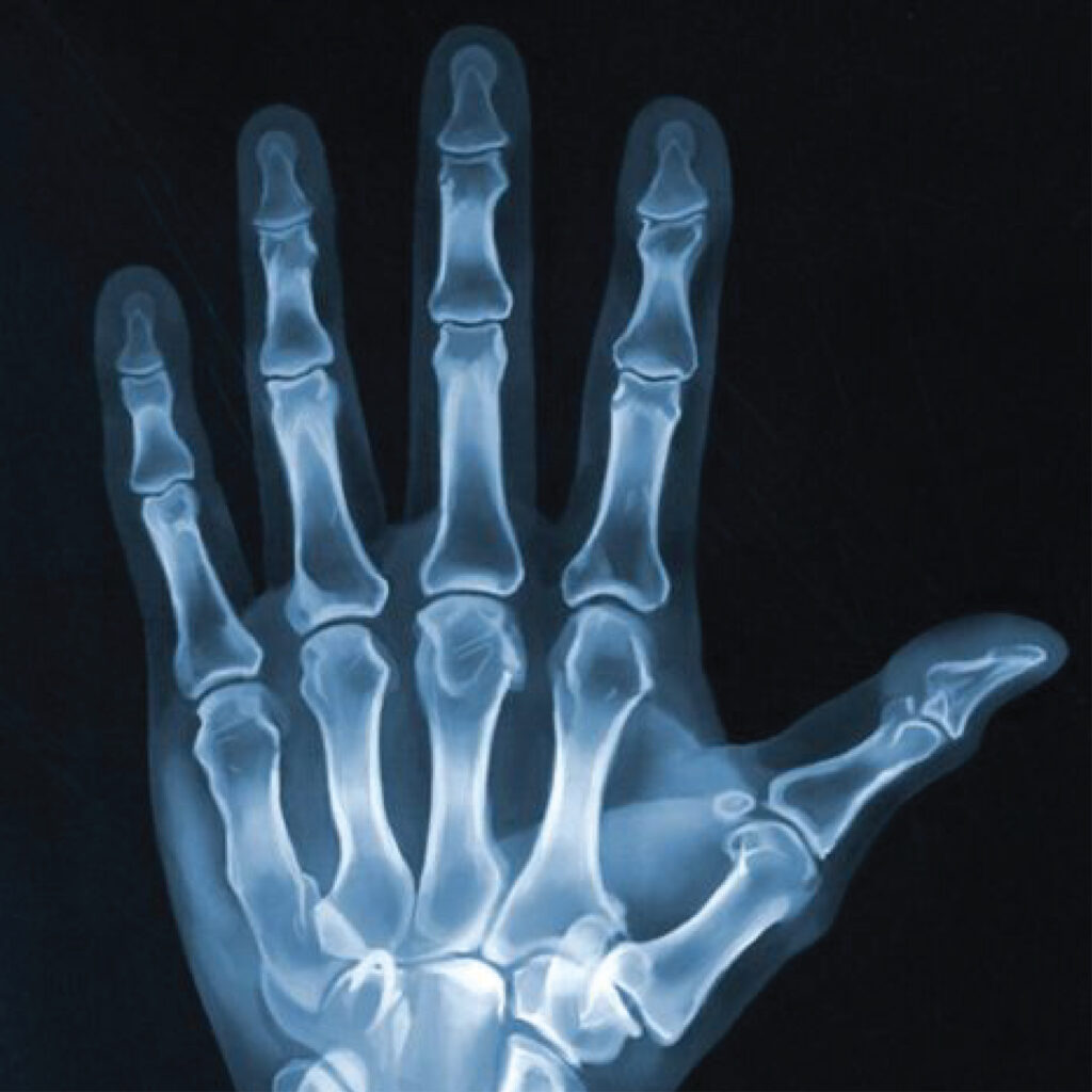 Bones & Joint X-Ray near me