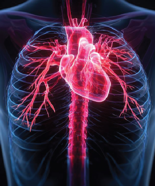 CT Angiography