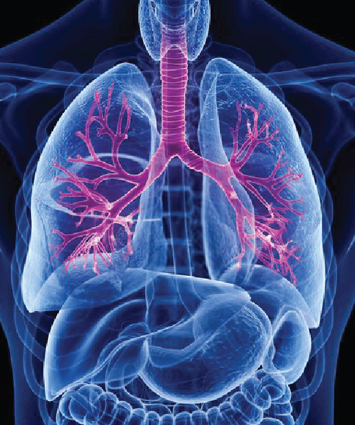 Chest CT Scan