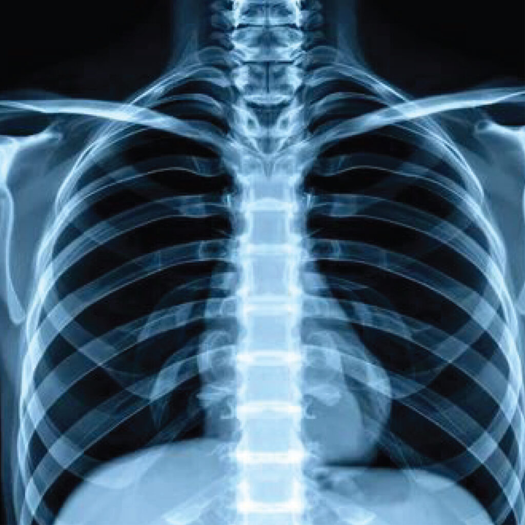 Jain Hospital Chest X-Ray