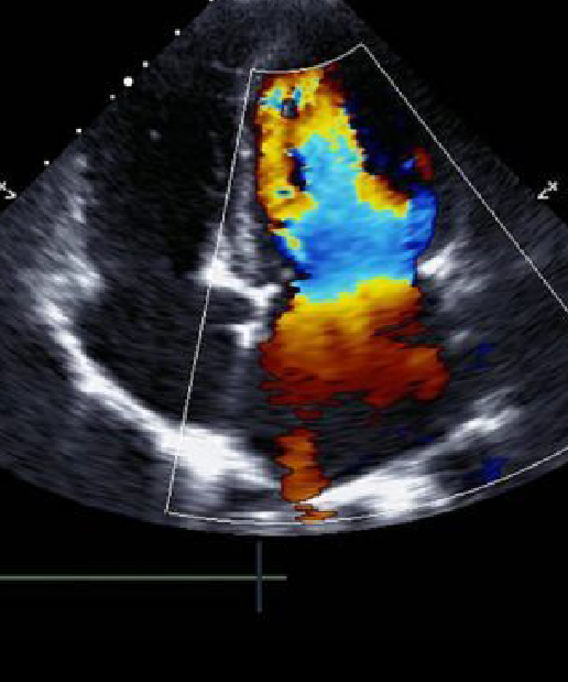 Jain Hospital Colour Doppler