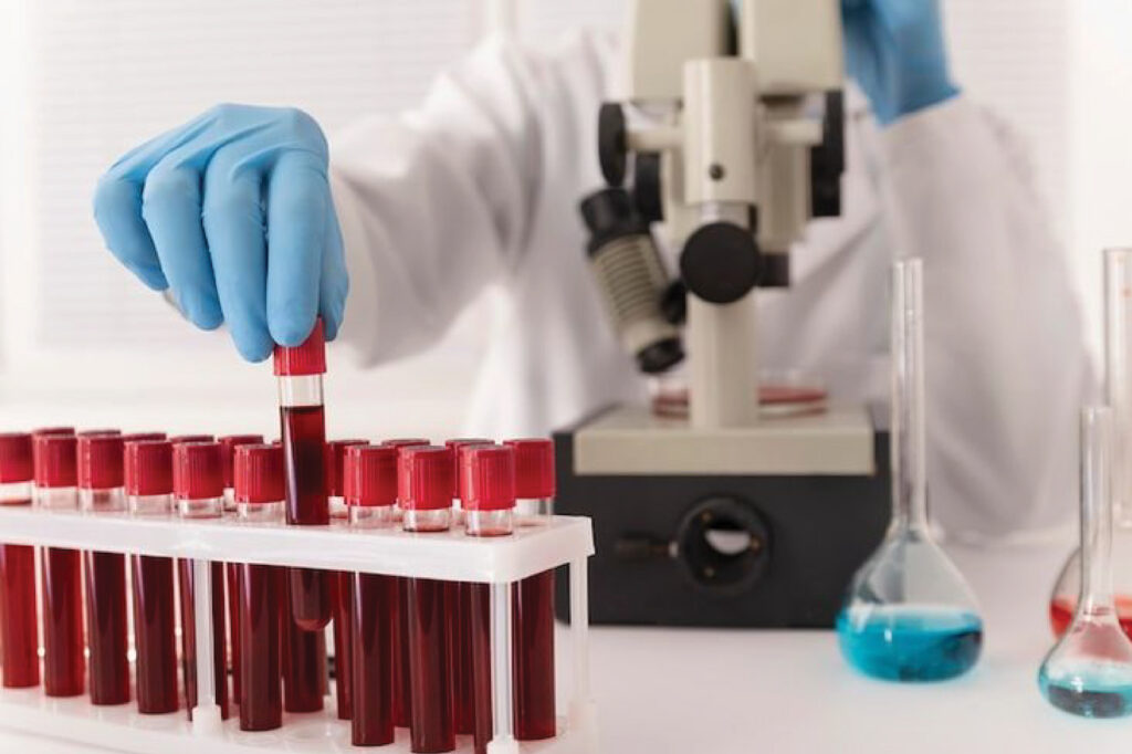 Jain Hospital Haematology