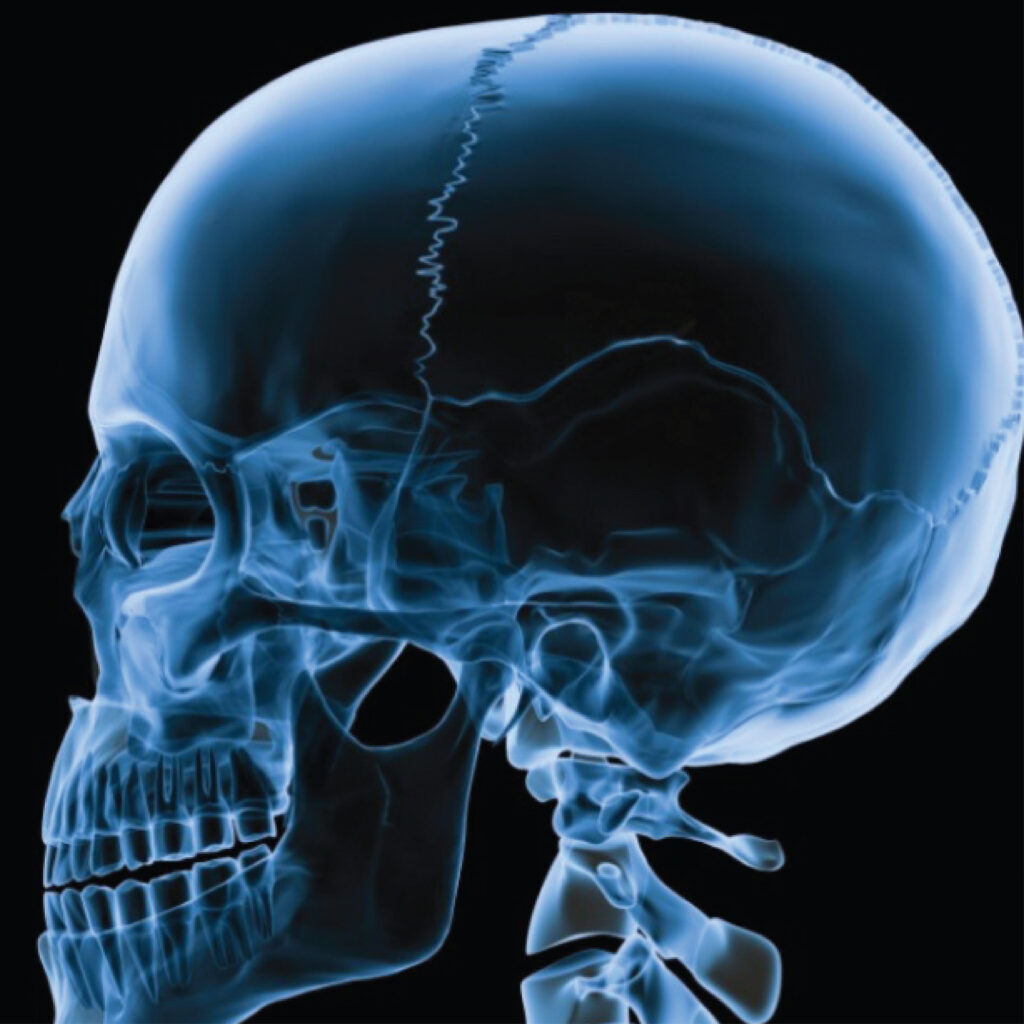 Jain Hospital Skull X-Ray