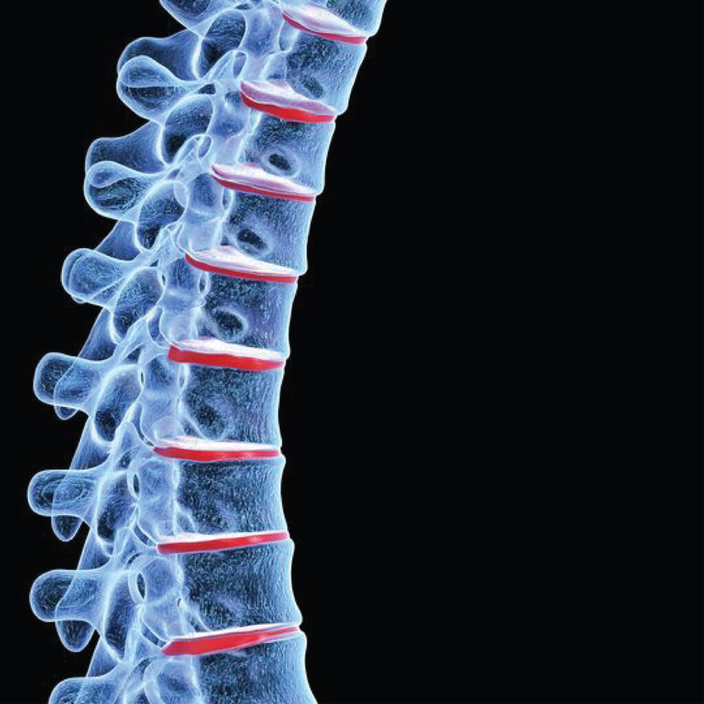Spine X- Ray east delhi