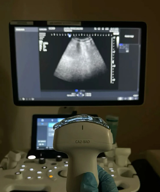 Jain Hospital USG Obstetric