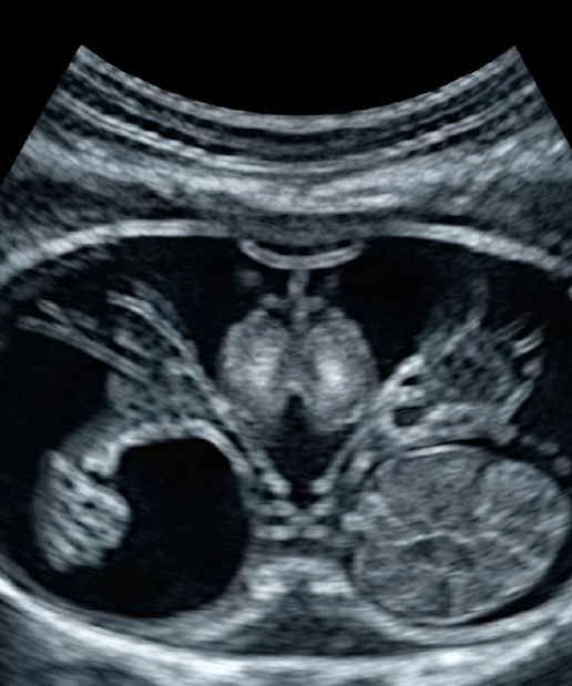 USG Pelvic