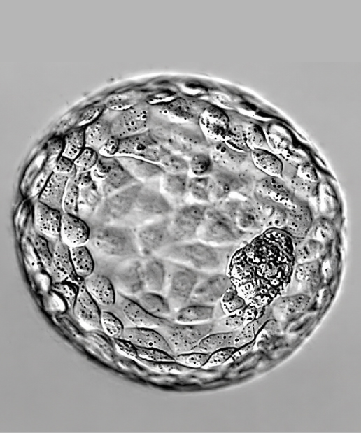 Blastrocyst Culture