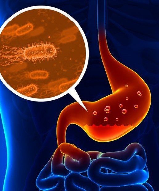 CT ScanAbdomen
