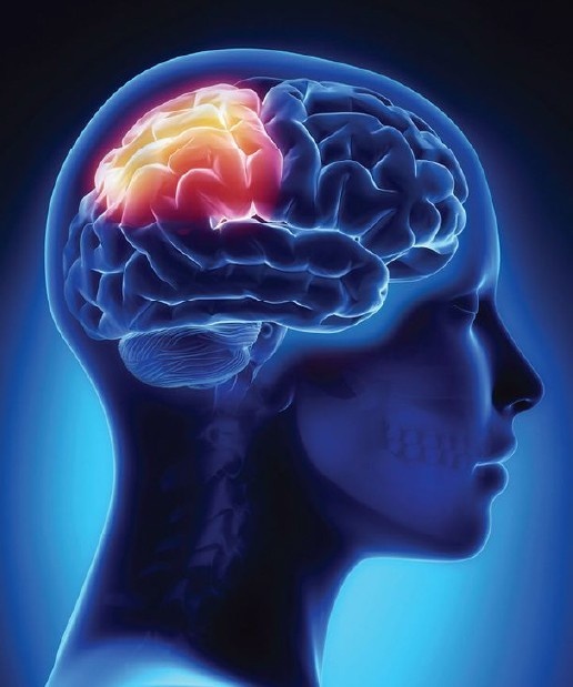 CTScanBrain