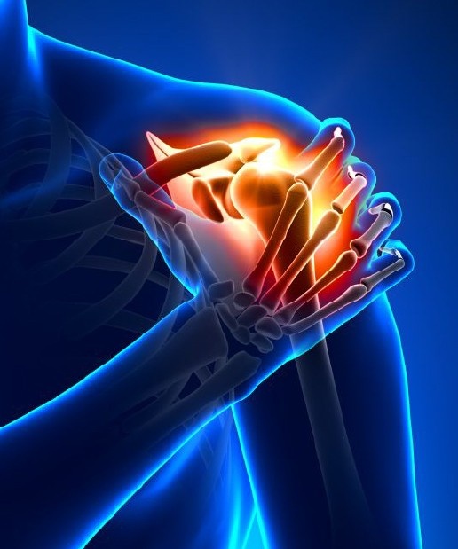 CTScanMusculoskeletal