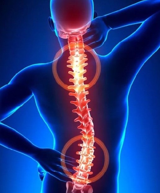CTScanSpine