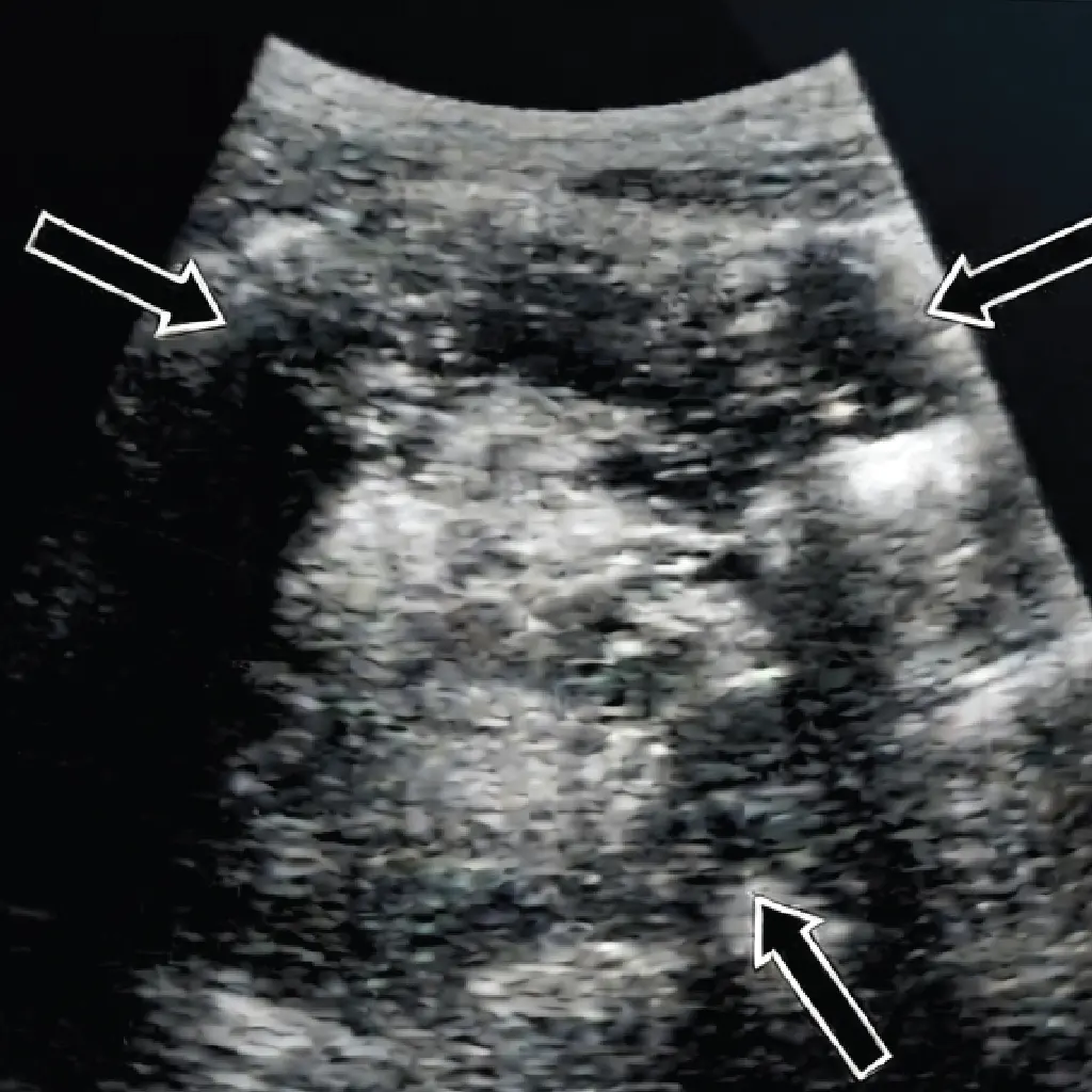 Gynaecology, Fertility, Pelvic Ultrasound