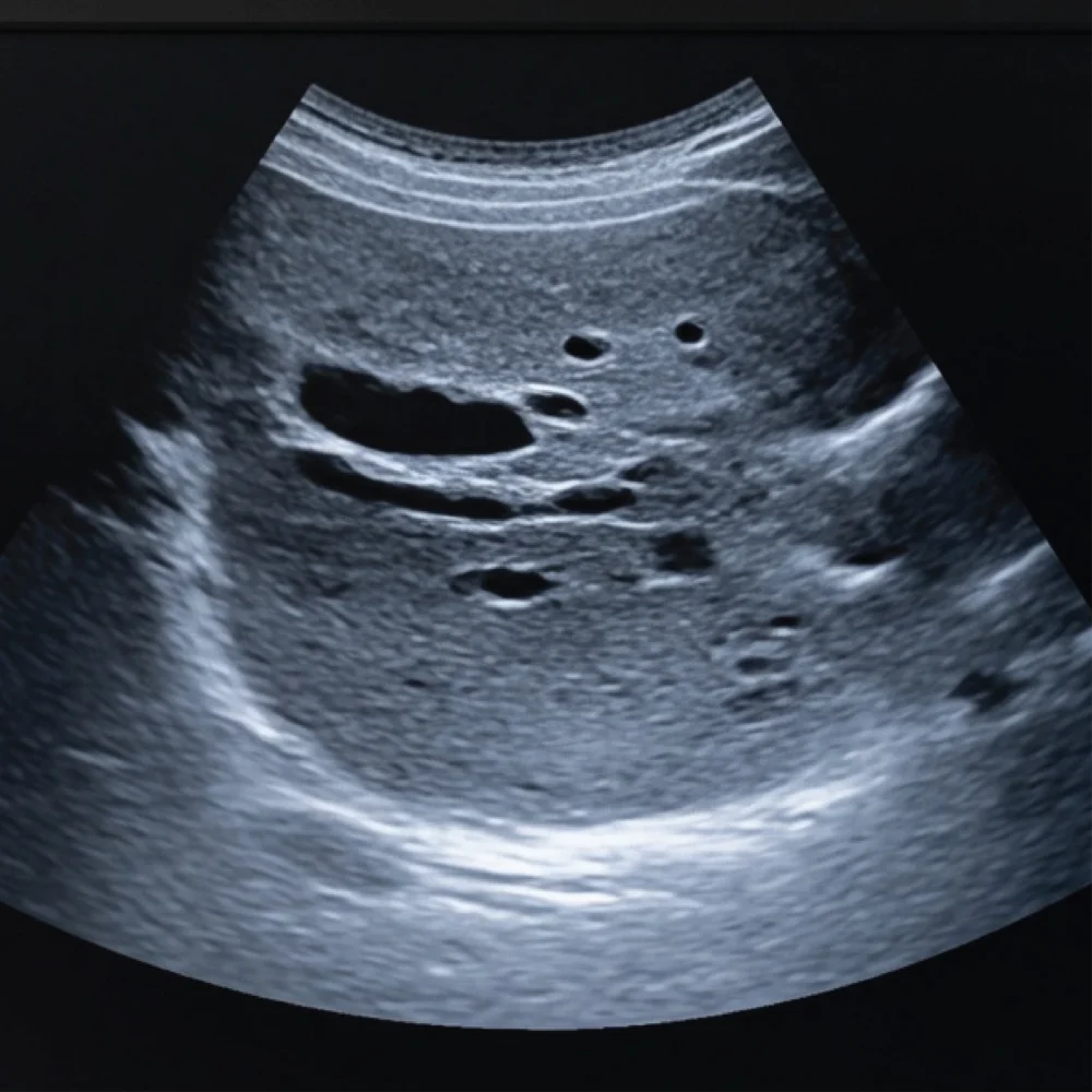 Abdomen, Pelvis & Urinary Tract