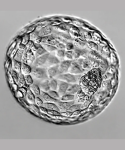 Blastrocyst Culture 