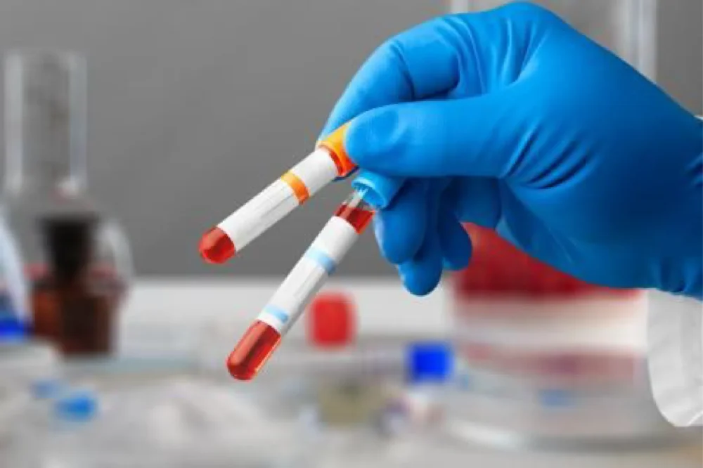 Body Fluid Analysis