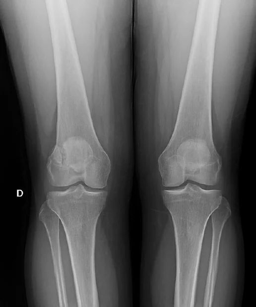 Bone & Joint X-Ray
