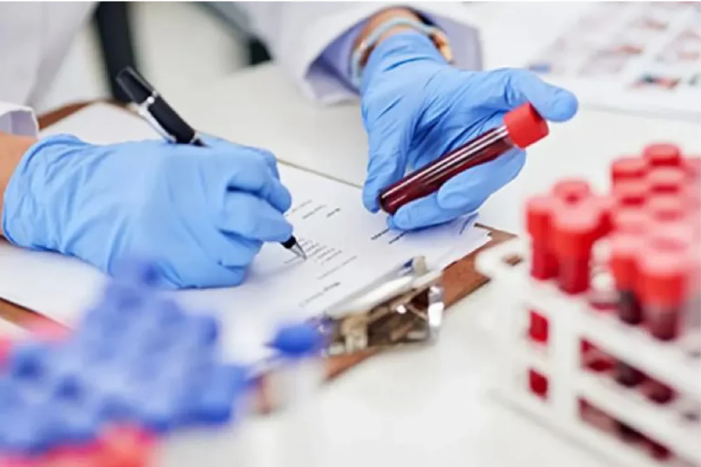 Drug Levels & Toxicology