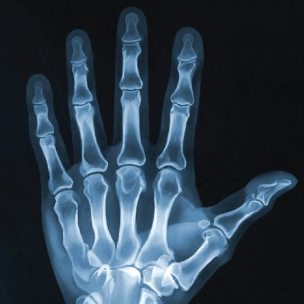 Extremities, Bones & Joints