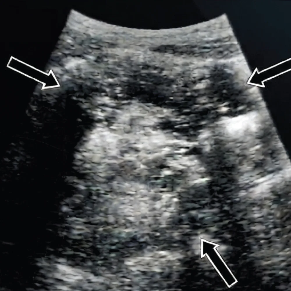Gynaecology, Fertility & Pelvic Ultrasound_