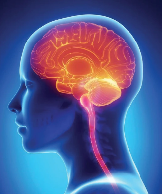 MRI Brain