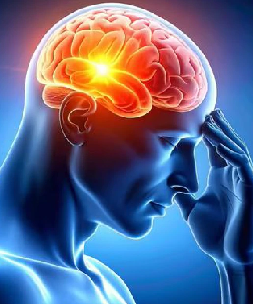 MRI Brain