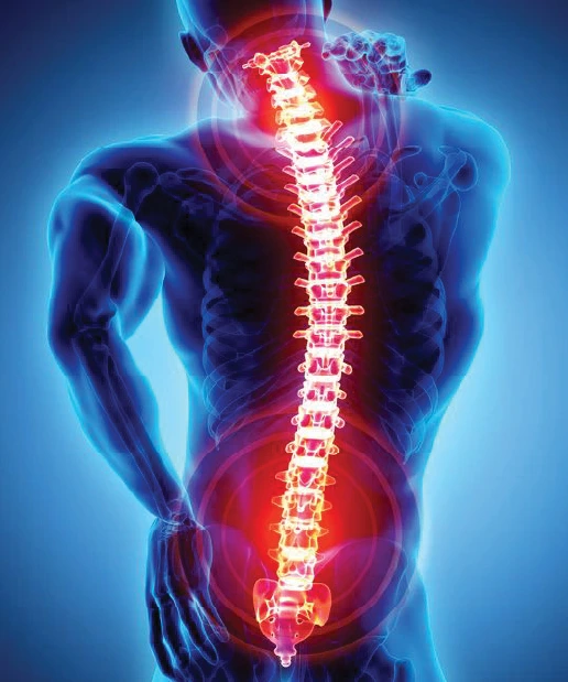 MRI Spine