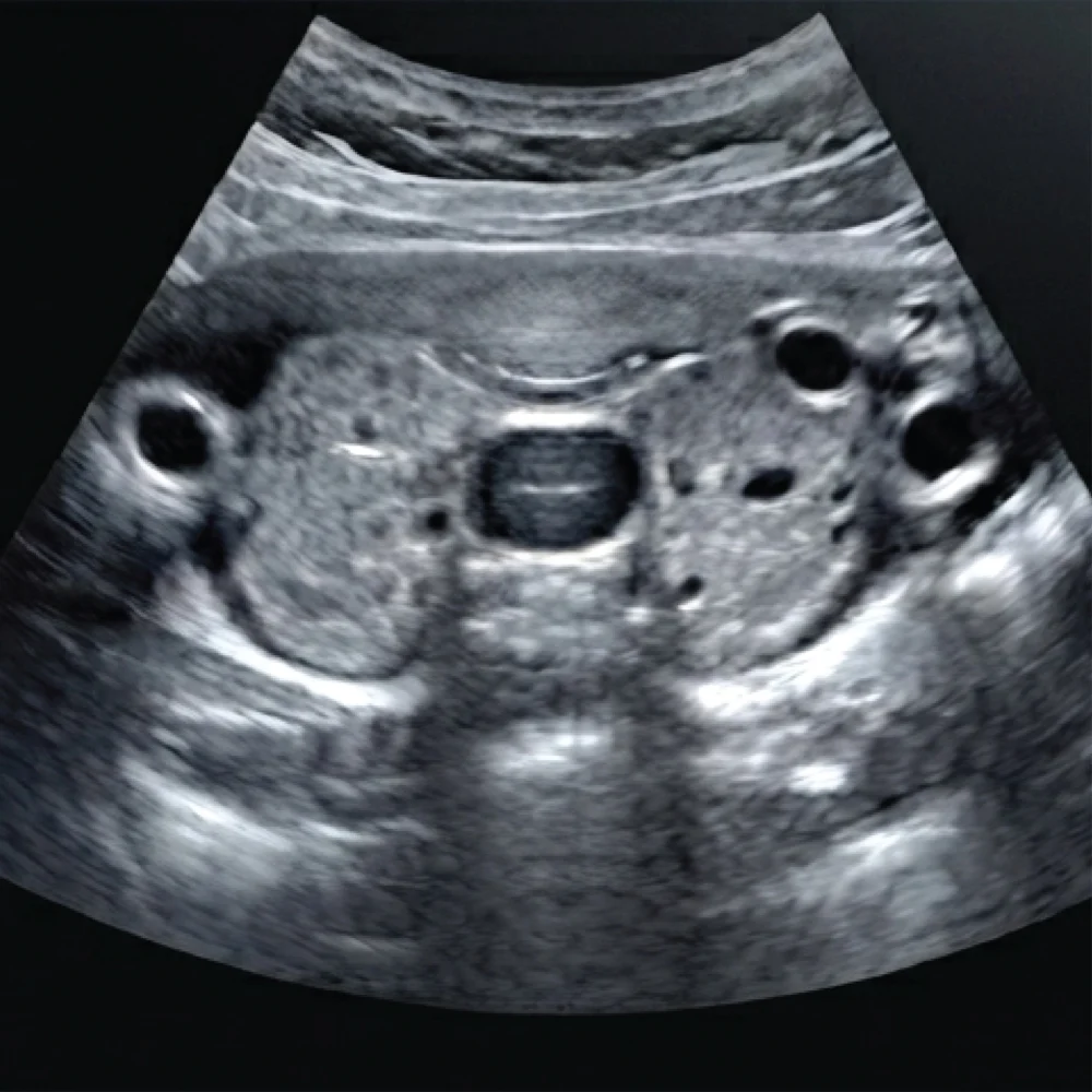 Small Parts, Neck, Chest, Breast & Musculoskeletal