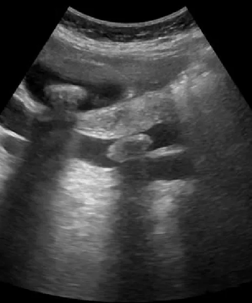 USG Abdomen