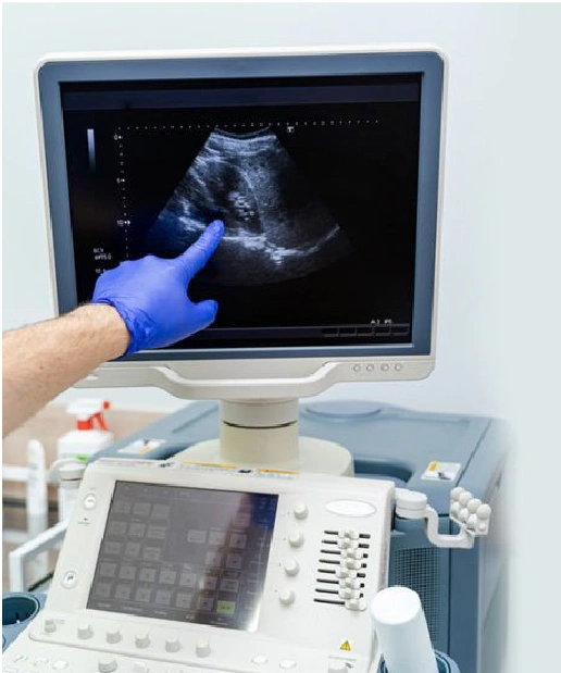 Ultrasound