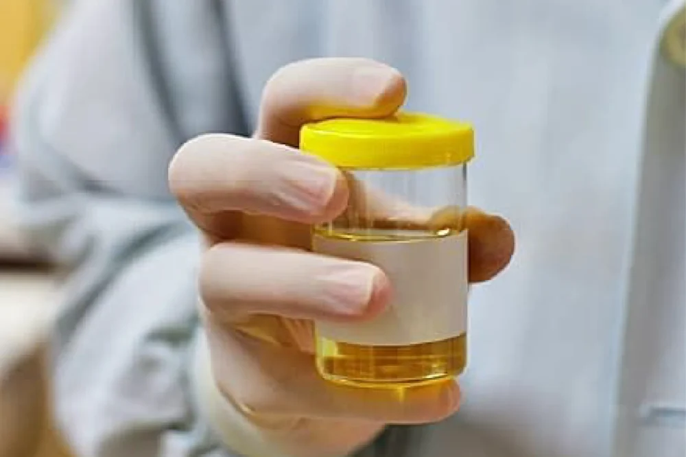 Urine & Stool Analysis