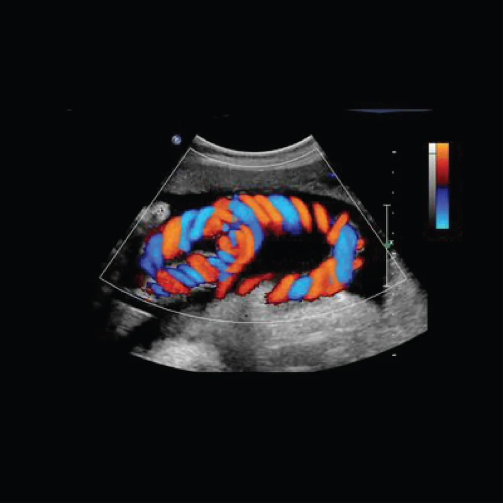Vascular Doppler Studies