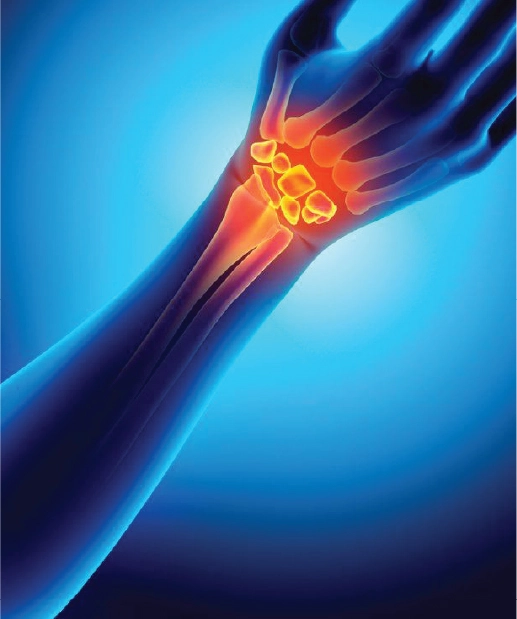 Bone & Joint Diseases