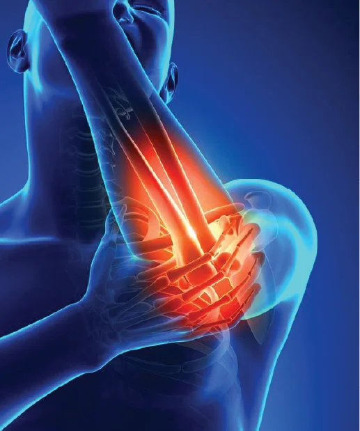 Fractures & Trauma (2)