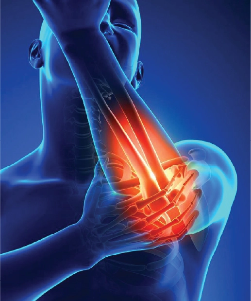 Fractures & Trauma