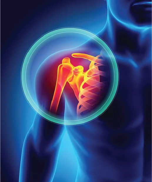 Shoulder & Elbow